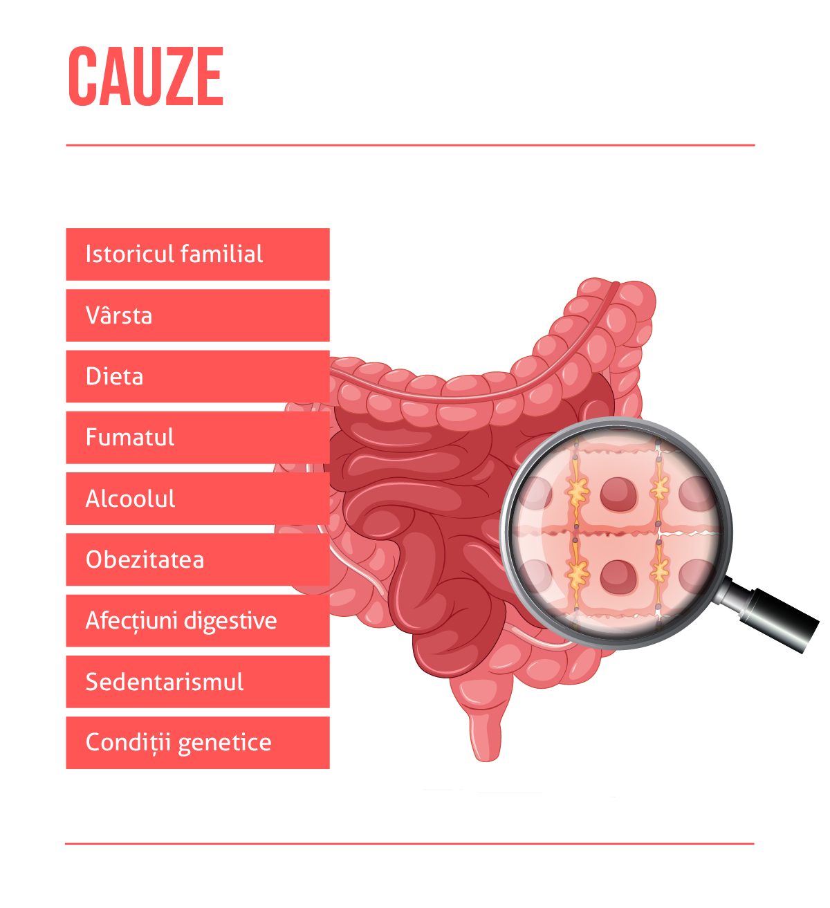 Cancer intestinal