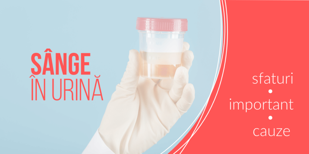 Ce ne dezvaluie urina despre starea noastra de sanatate - Farmacia Alphega
