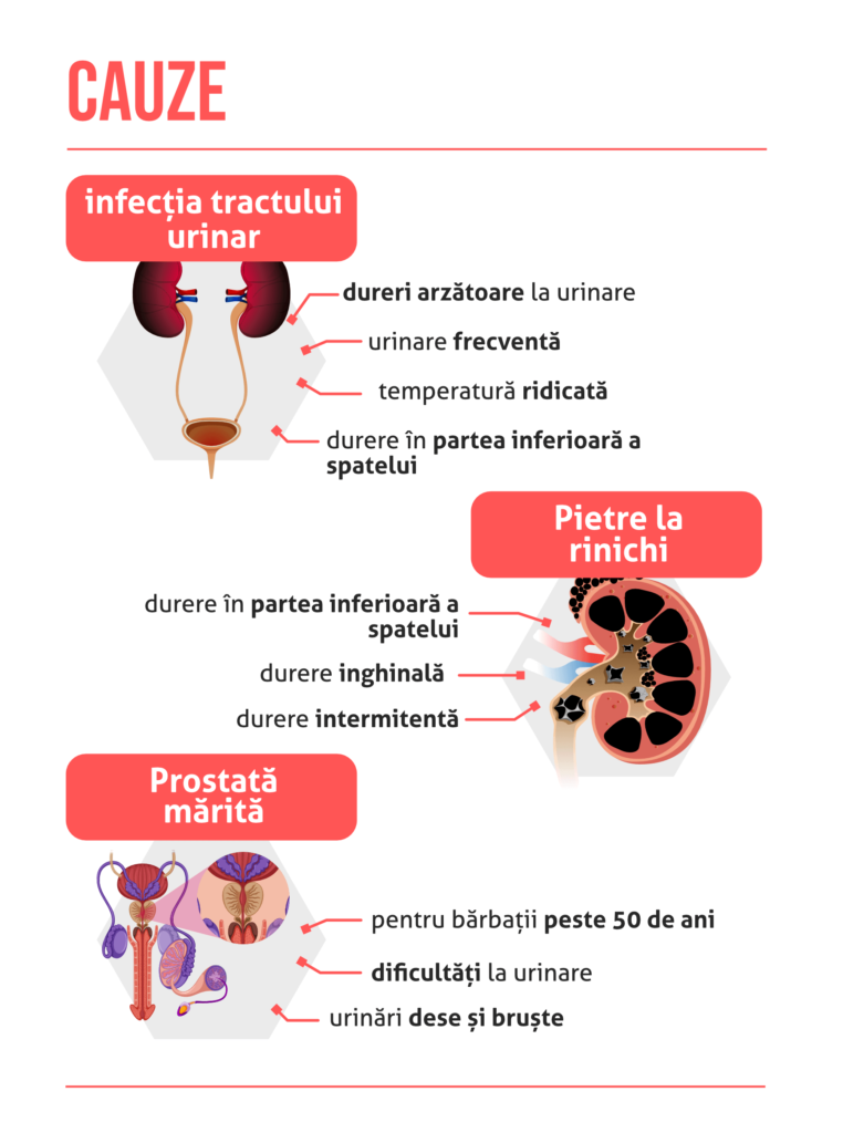Incontinența urinară - Cauze, diagnostic și tratament