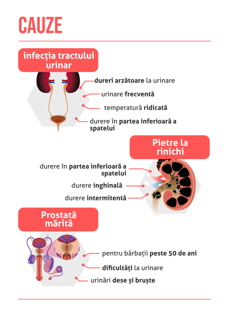 urinat cu sange la barbati cauze