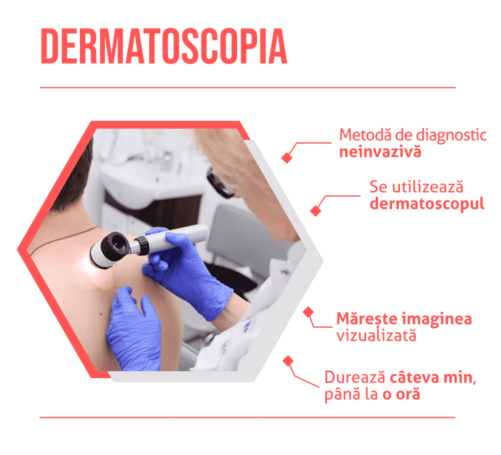 Dermatoscopia