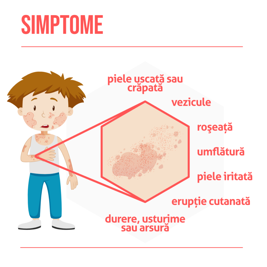 Simptomele dermatitei