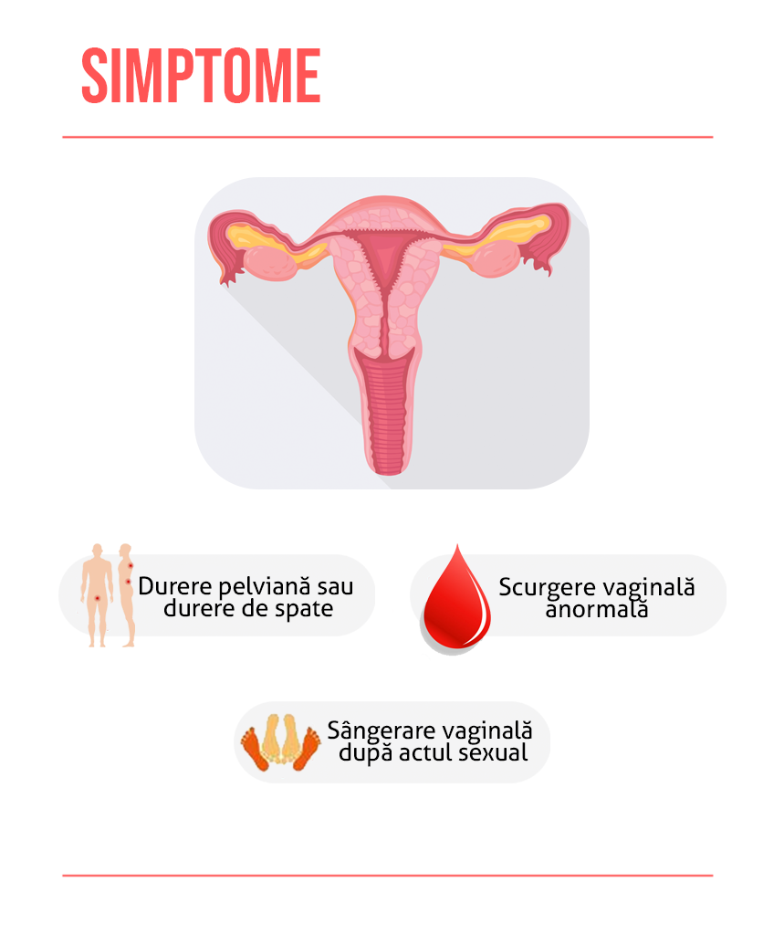 Simptome cancer de col uterin