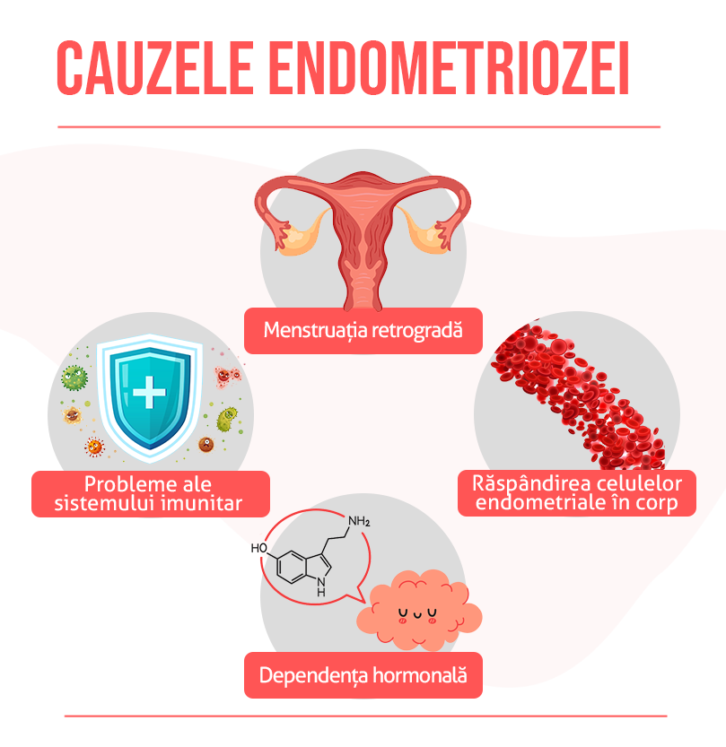 Cauze endometriozei