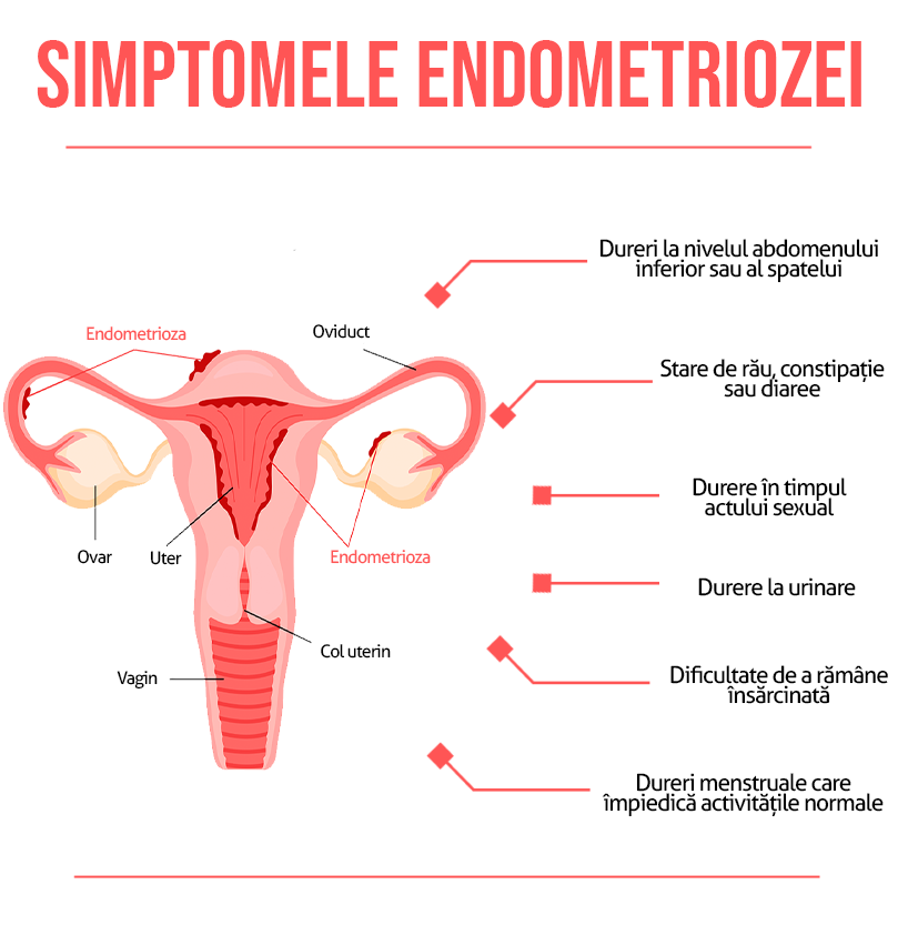 Simptomele endometriozei