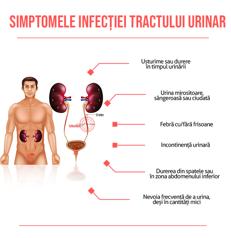 educate doubt Maxim Infecția urinară: Cauze, Simptome, Tratament și Prevenire - Medic Chat