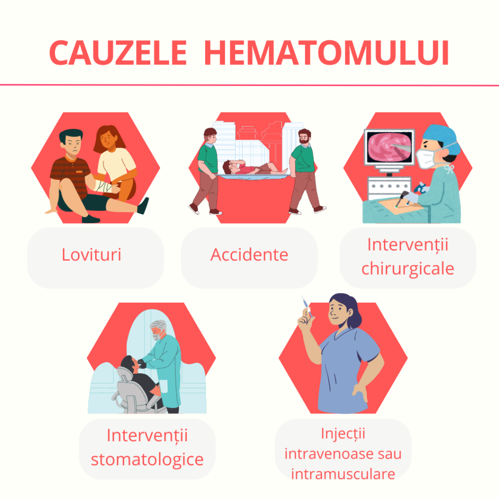 cauzele hematomului