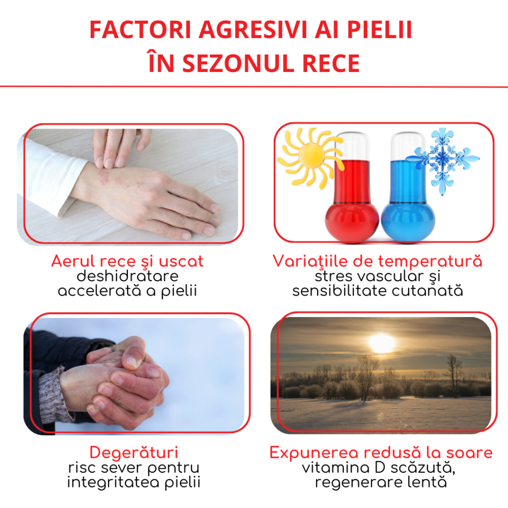 factori agresivi ai pielii in sezonul rece
