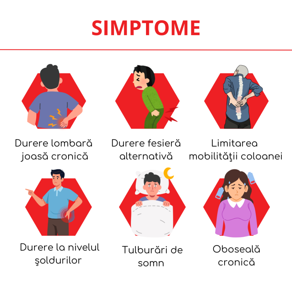 simptome spondilita anchilozanta