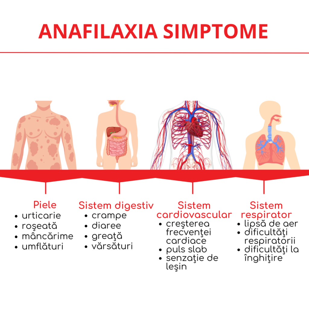 anafilaxia simptome
