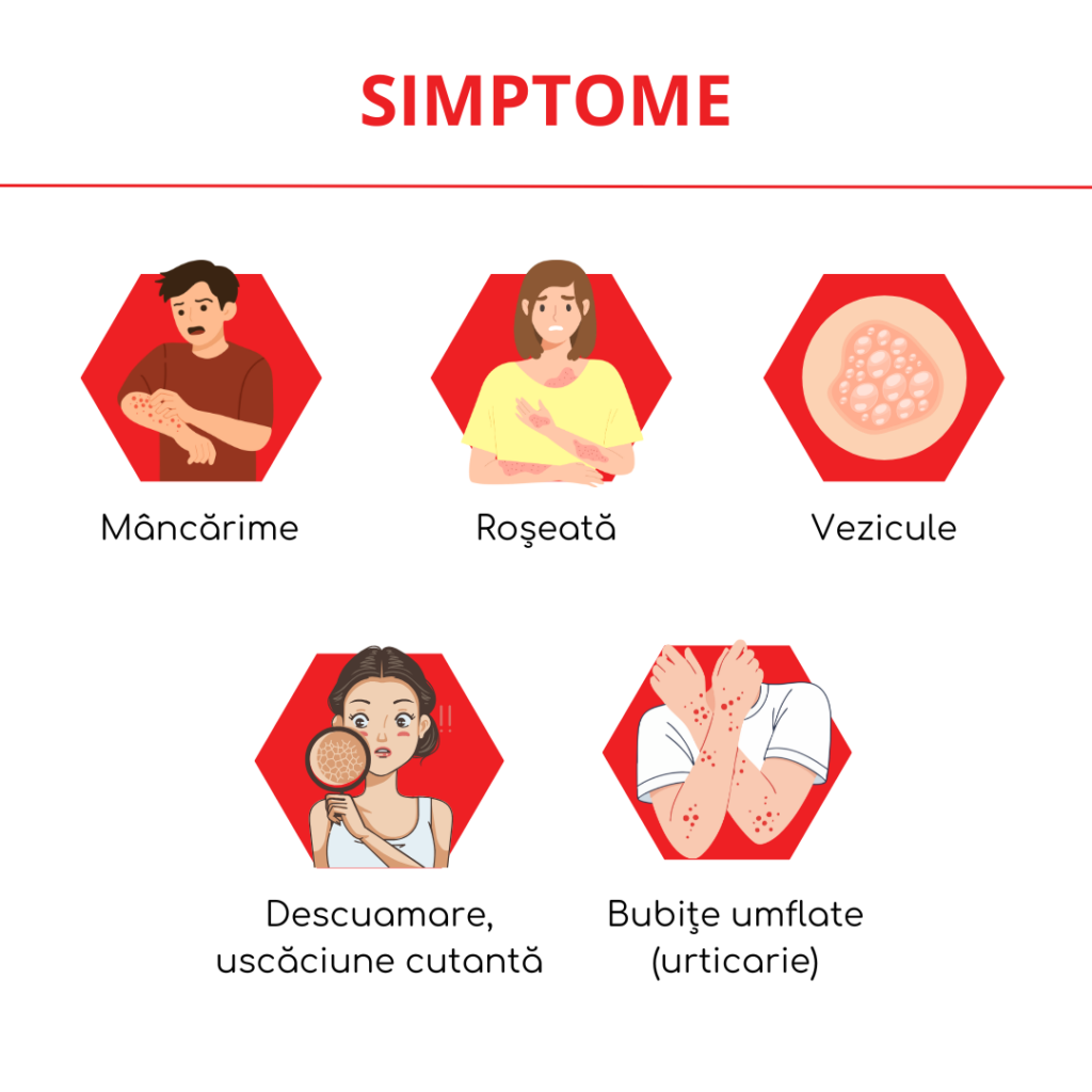 simptomele alergiilor cutanate