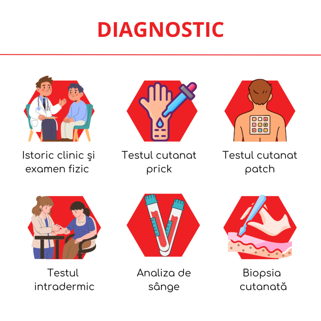 diagnosticul alergiilor cutanate